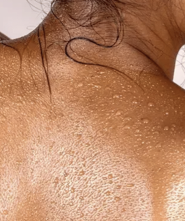 En kvinna fotad bakifrån med droppar på ryggen. Halvkropp.